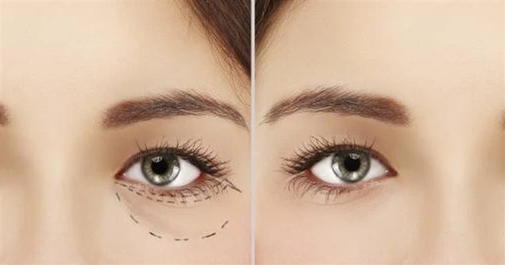 Eyeliss Powder