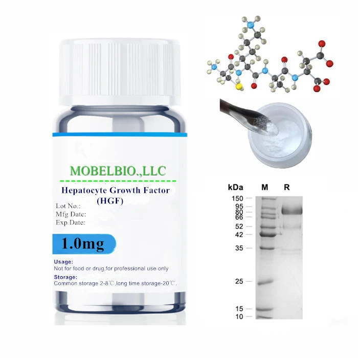 Hepatocyte Growth Factor