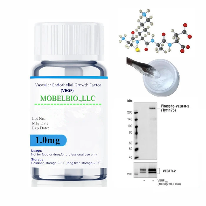Vascular Endothelial Growth Factor VEGF