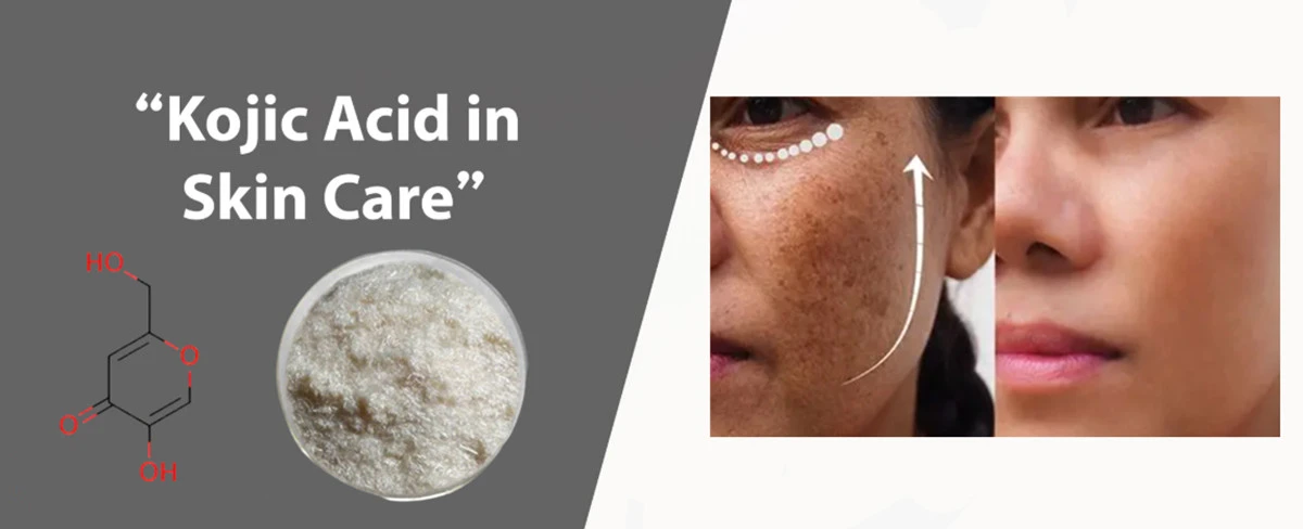 Kojic Acid cosmetic grade Kojic Acid cosmetic grade